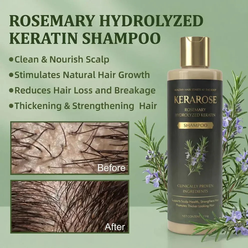 Product Title  Kerarose Rosemary Hair Growth Shampoo | Rosemary + Keratin Formula | Buy 1 Get 1 Free