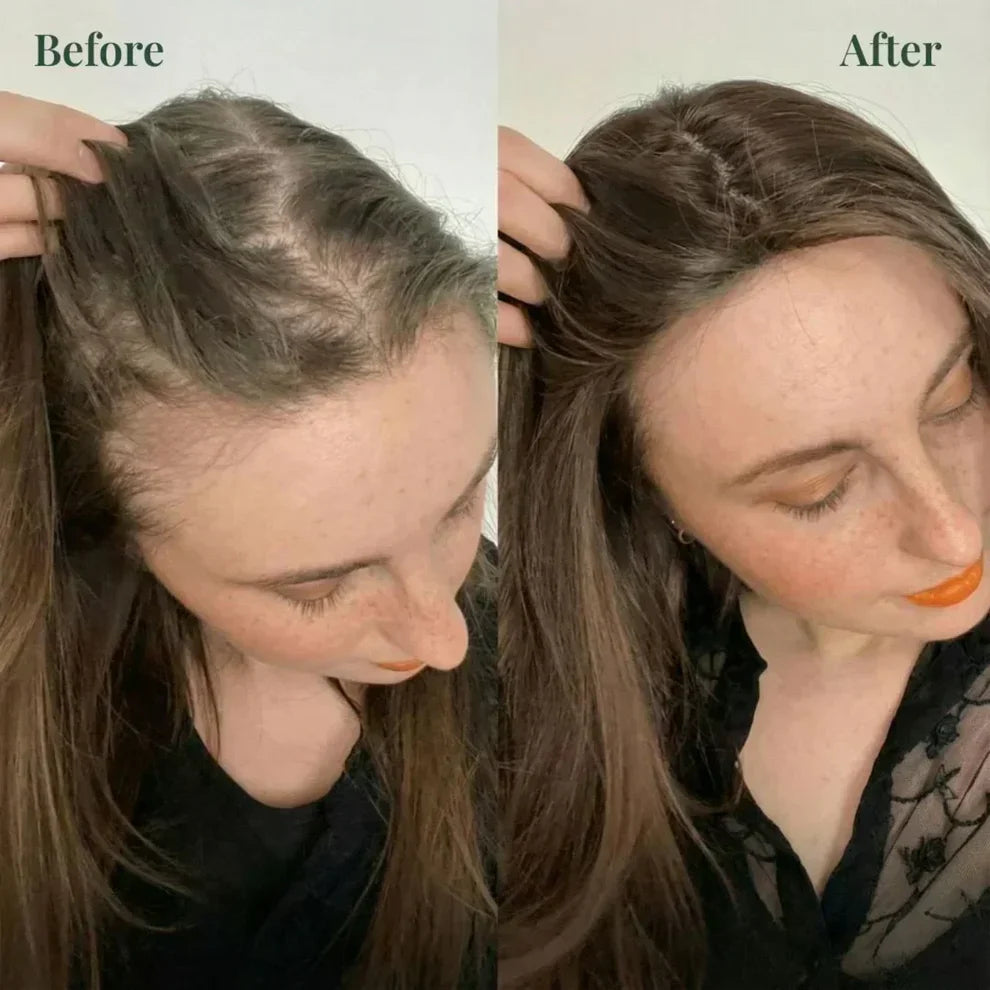 Product Title  Kerarose Rosemary Hair Growth Shampoo | Rosemary + Keratin Formula | Buy 1 Get 1 Free