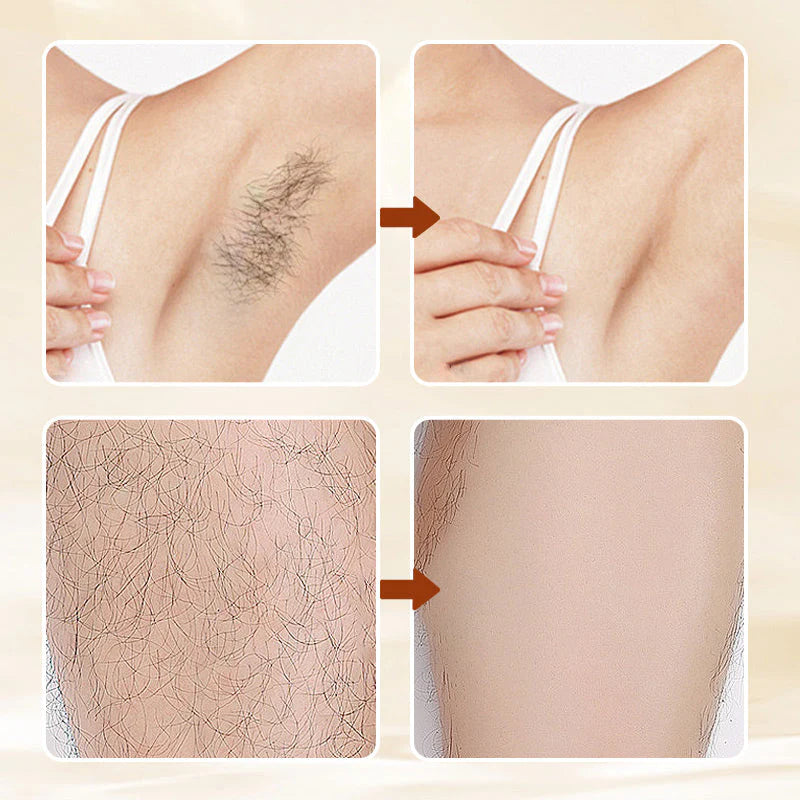 Pack of 2 | Gentle Formula Hair Removal Cream with Fresh Fragrance